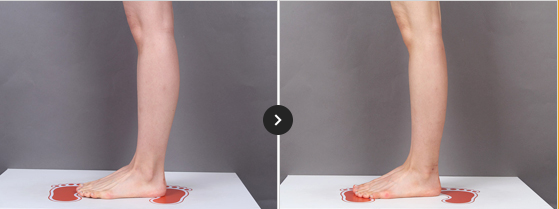 365mc BEFORE & AFTER