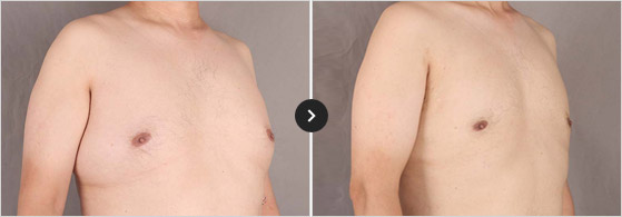 365mc BEFORE & AFTER
